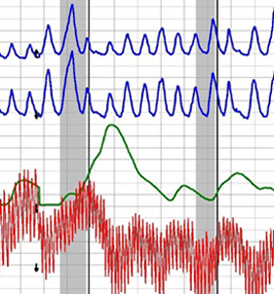 Maryland polygraph test